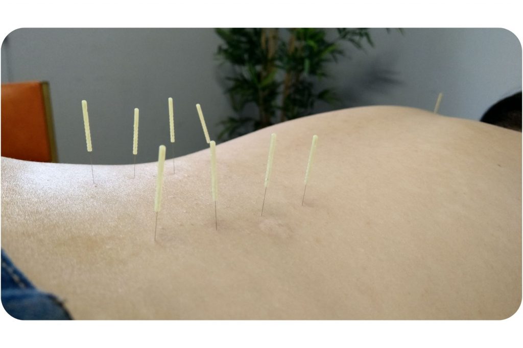 Living-Chi-Chinese-Medicine